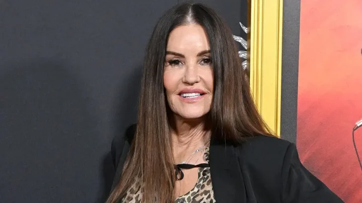 Former supermodel Janice Dickinson unveils dramatic results of facelift at 71