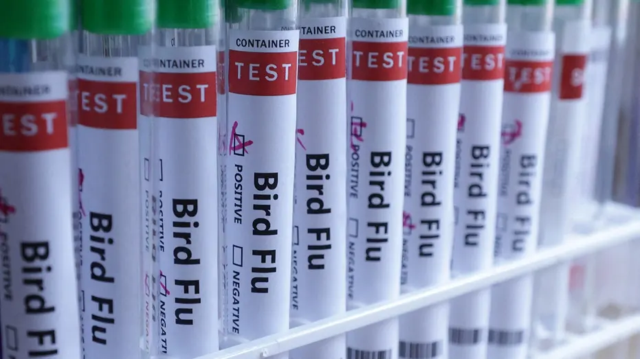 bird-flu-test-tubes-fox-news-001