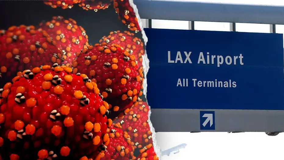 measles-case-in-LA-county